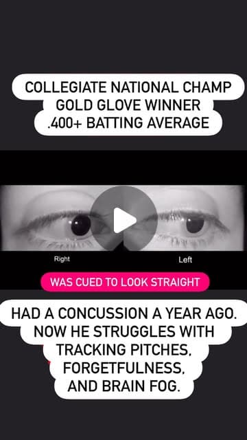 A college hitter's eyes in VNG goggles, cued to look straight