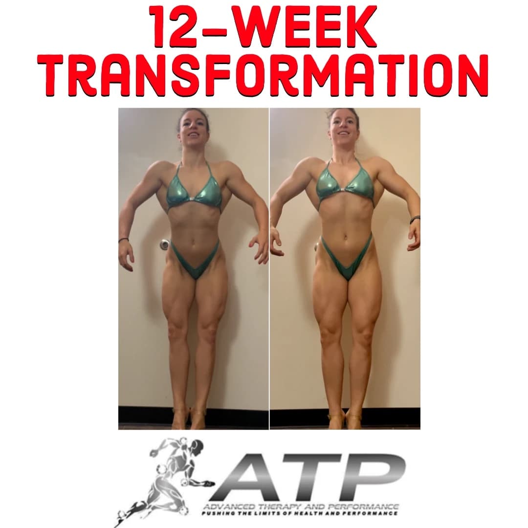 Eleni A., before and after, 2021