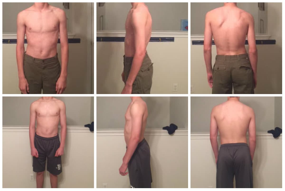 Garrett, before and after, 2015